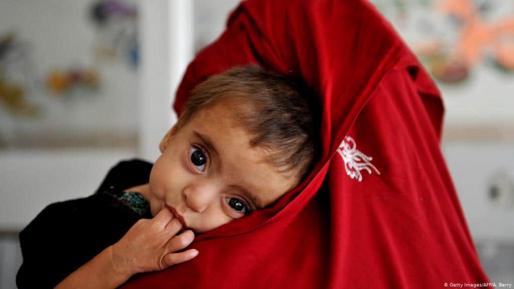 Photo of هفت میلیون کودک در افغانستان در معرض خطر گرسنگی