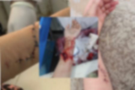 هرات؛ مخالفت با ازدواج اجباری و دو اقدام به خودکشی